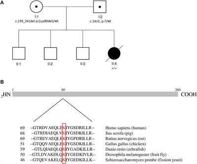 Case Report: DPM1-CDG: Novel Variant with Severe Phenotype and Literature Review